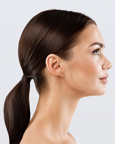 Jawline Contouring, California Skin, Ihre Experten für Faltenbehandlungen in Landshut